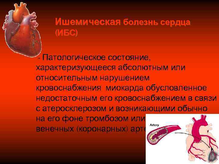   Ишемическая болезнь сердца (ИБС)  - Патологическое состояние, характеризующееся абсолютным или относительным