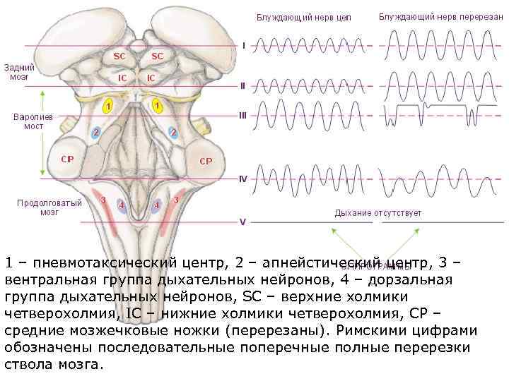 1 – пневмотаксический центр, 2 – апнейстический центр, 3 – вентральная группа дыхательных нейронов,