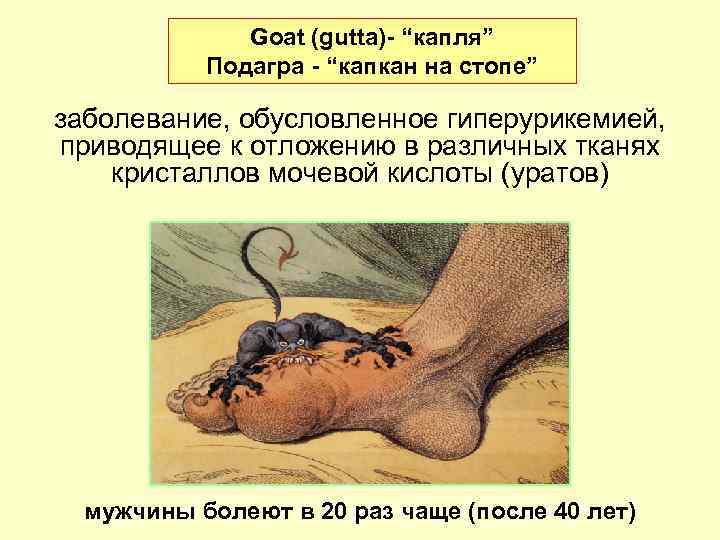    Goat (gutta)- “капля”  Подагра - “капкан на стопе” заболевание, обусловленное