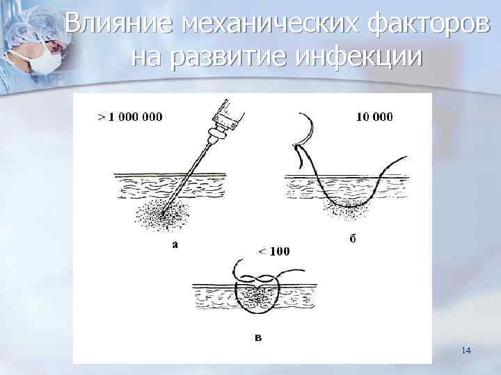 Влияние механических факторов на развитие инфекции      14 