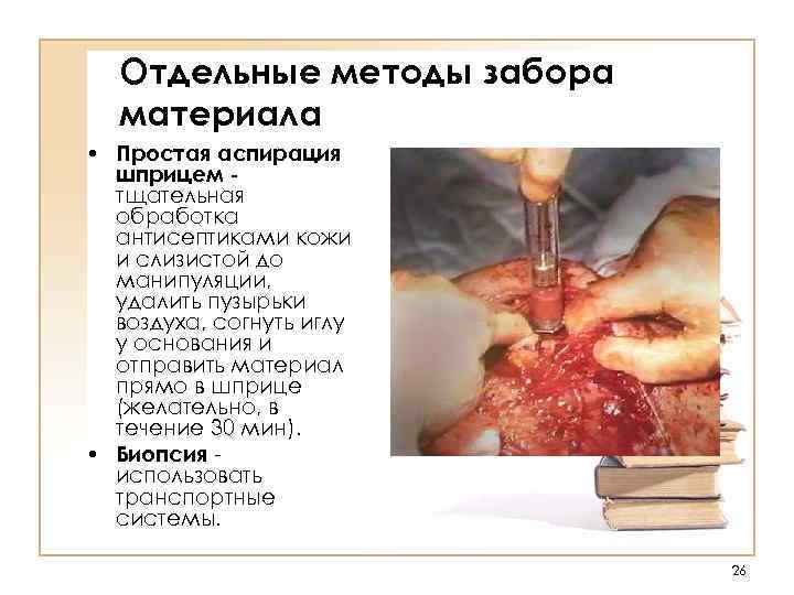 Отдельные методы забора  материала • Простая аспирация  шприцем -  тщательная