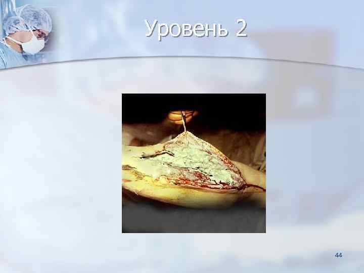 Уровень 2   44 
