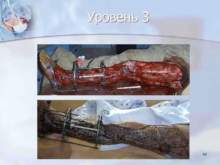 Уровень 3   46 