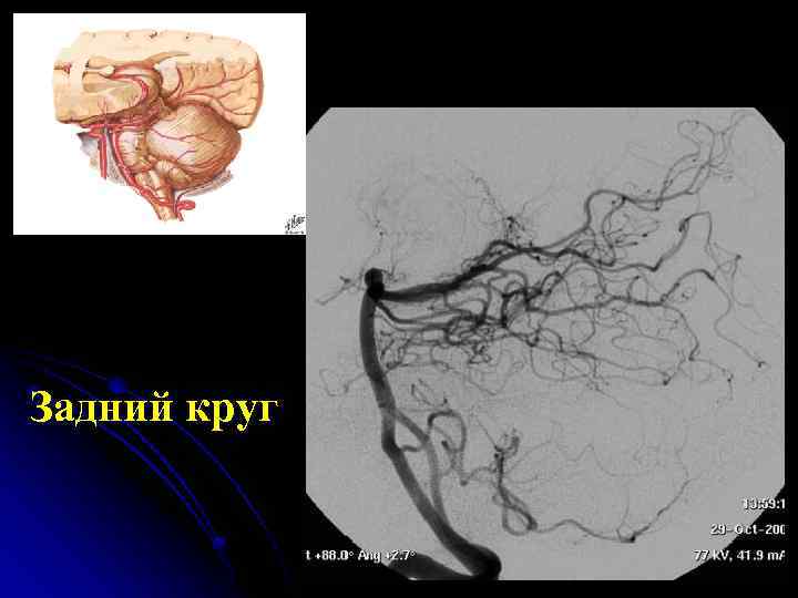 Задний круг 