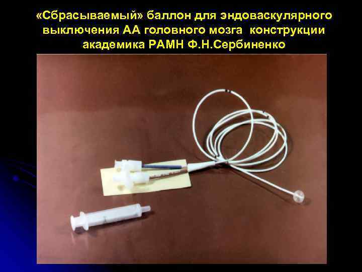  «Сбрасываемый» баллон для эндоваскулярного выключения АА головного мозга конструкции академика РАМН Ф. Н.