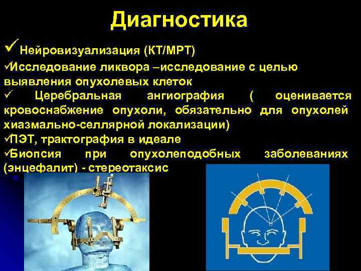     Диагностика üНейровизуализация (КТ/МРТ) üИсследование ликвора –исследование с целью выявления опухолевых