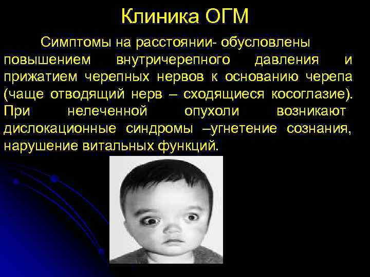     Клиника ОГМ Симптомы на расстоянии- обусловлены повышением  внутричерепного 