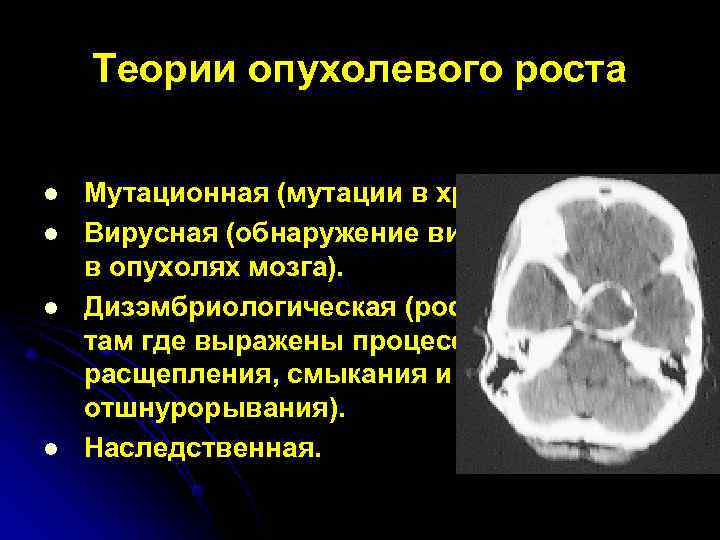   Теории опухолевого роста  l  Мутационная (мутации в хромосомах). l 