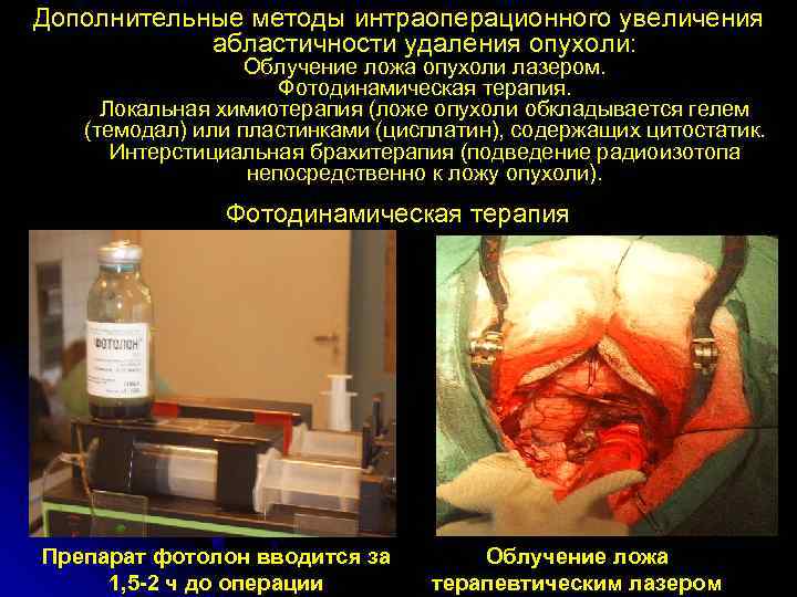 Дополнительные методы интраоперационного увеличения   абластичности удаления опухоли:    Облучение ложа