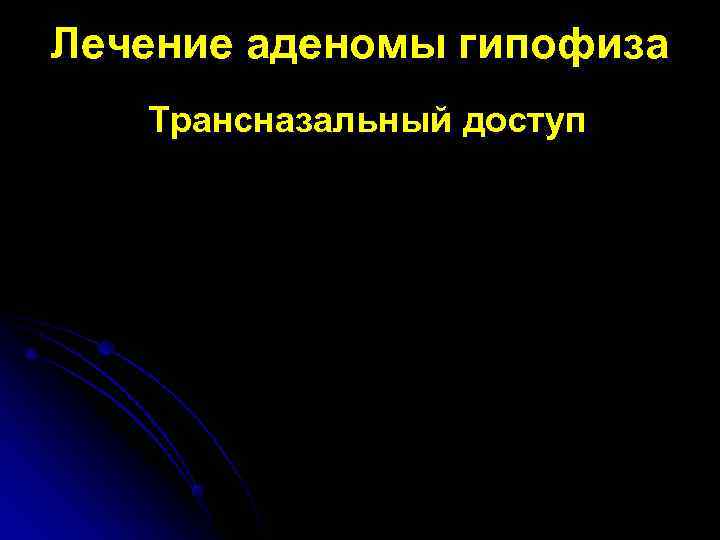 Лечение аденомы гипофиза  Трансназальный доступ 