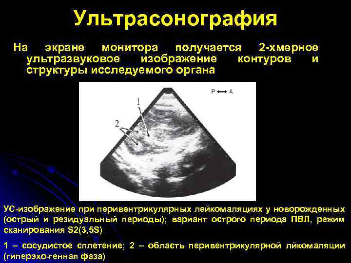 Негативное изображение исследуемого органа на фотопленке