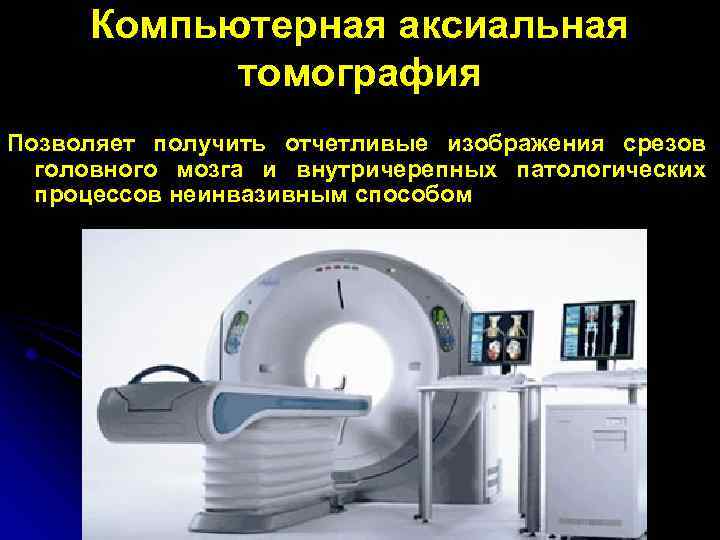 Компьютерная томография головного мозга где сделать