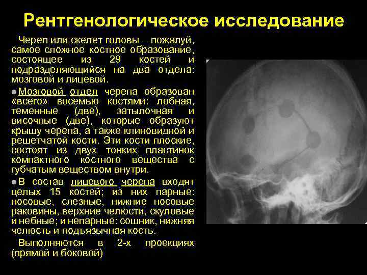 Рентгенологическое исследование Череп или скелет головы – пожалуй, самое сложное костное образование, состоящее из