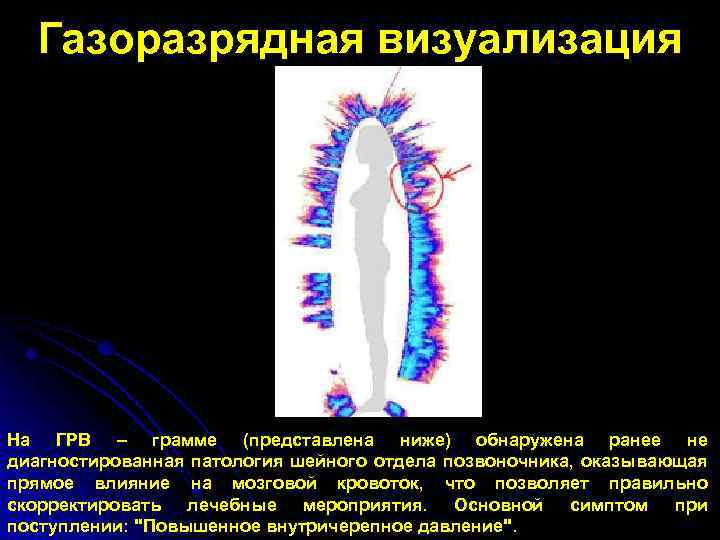 Газоразрядная визуализация На ГРВ – грамме (представлена ниже) обнаружена ранее не диагностированная патология шейного