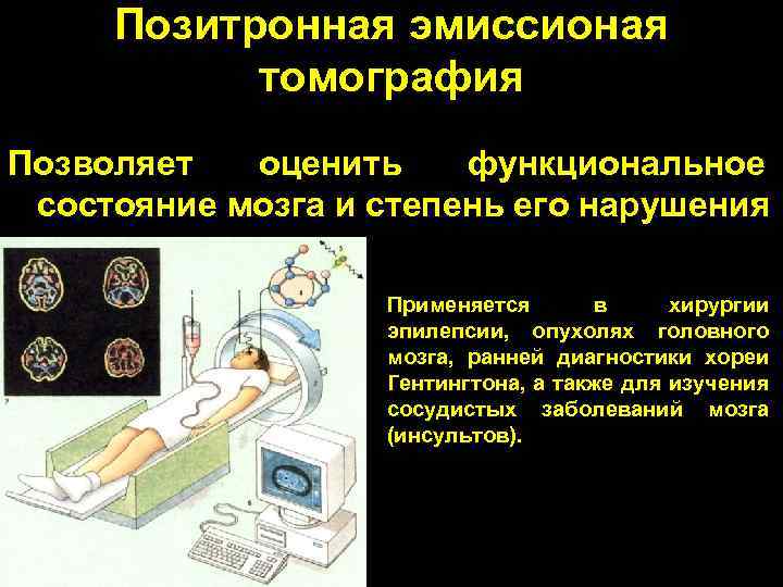 Позитронная эмиссионая томография Позволяет оценить функциональное состояние мозга и степень его нарушения Применяется в