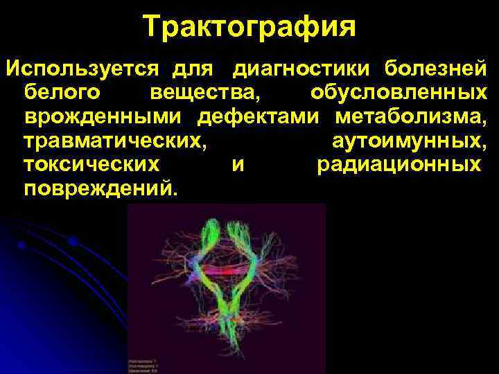 Трактография Используется для диагностики болезней белого вещества, обусловленных врожденными дефектами метаболизма, травматических, аутоимунных, токсических