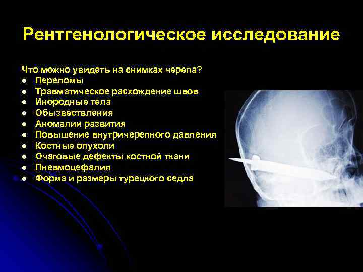 Рентгенологическое исследование Что можно увидеть на снимках черепа? l Переломы l Травматическое расхождение швов