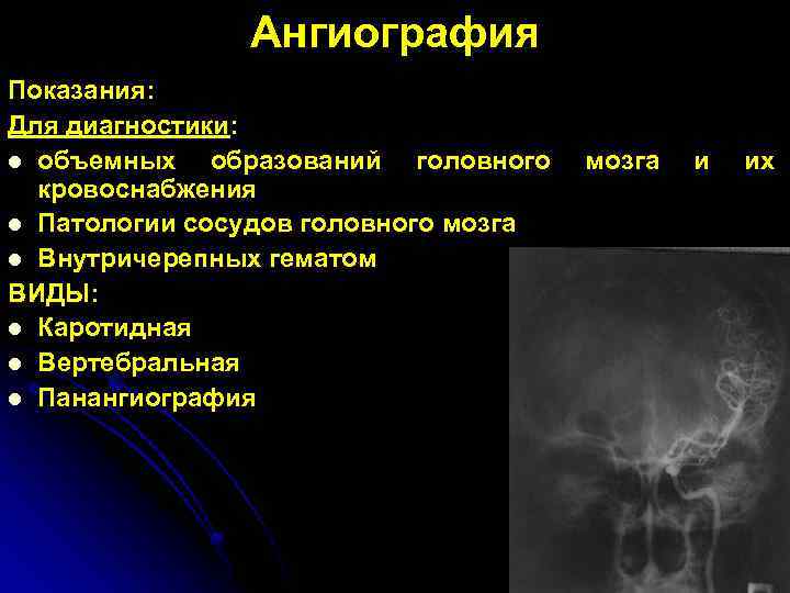 Ангиография Показания: Для диагностики: l объемных образований головного мозга и их кровоснабжения l Патологии