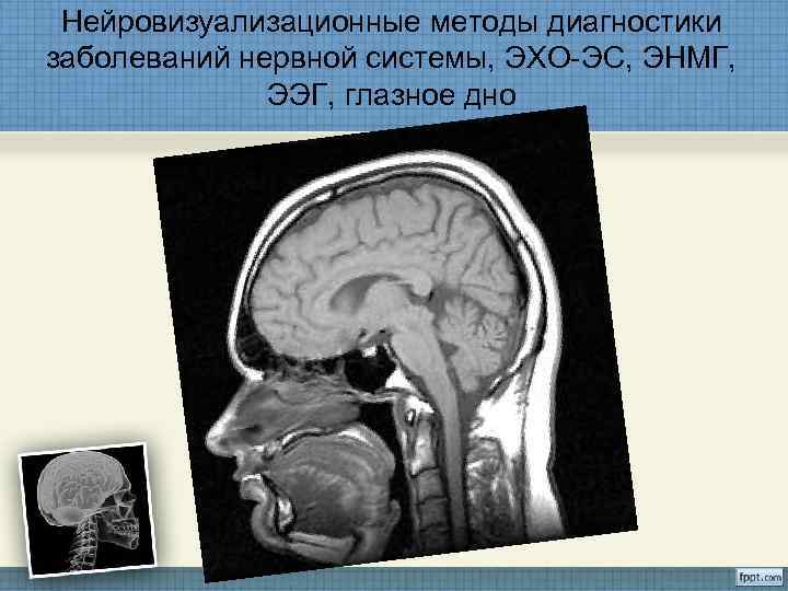  Нейровизуализационные методы диагностики заболеваний нервной системы, ЭХО-ЭС, ЭНМГ,   ЭЭГ, глазное дно