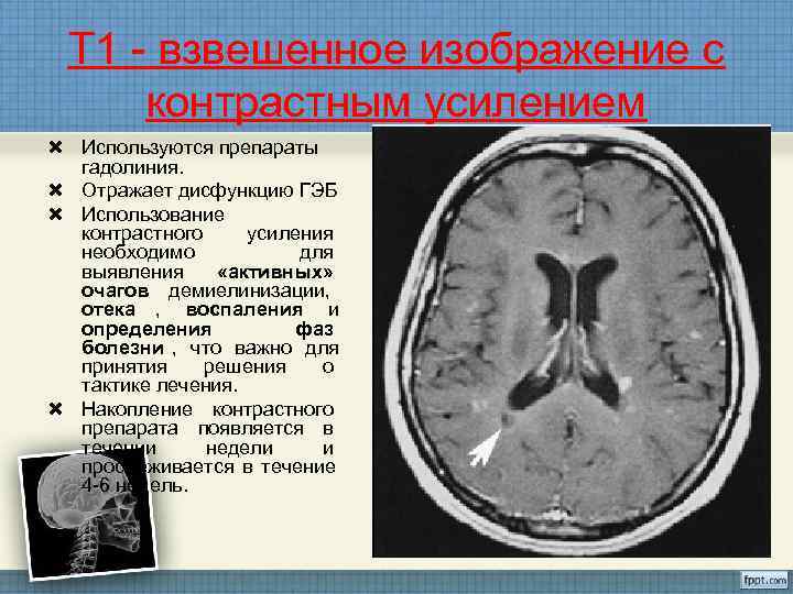 Взвешенных по т1 и т2