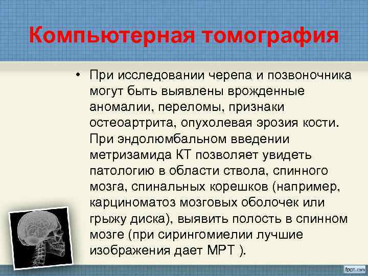 Компьютерная томография • При исследовании черепа и позвоночника  могут быть выявлены врожденные 