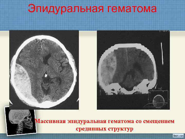 Параорбитальная гематома карта вызова скорой медицинской