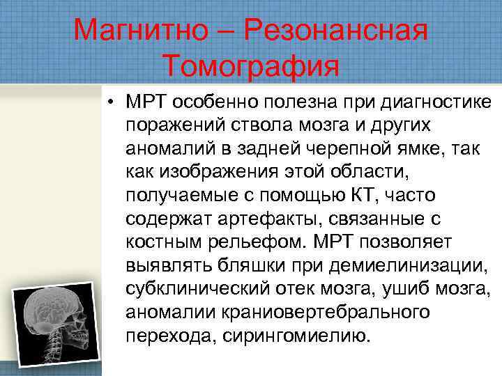 Магнитно – Резонансная  Томография  • МРТ особенно полезна при диагностике поражений ствола
