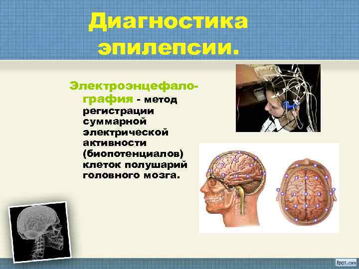  Диагностика  эпилепсии. Электроэнцефало- графия - метод регистрации суммарной электрической активности (биопотенциалов) клеток