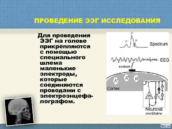 ПРОВЕДЕНИЕ ЭЭГ ИССЛЕДОВАНИЯ Для проведения ЭЭГ на голове прикрепляются с помощью специального шлема маленькие