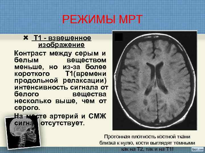 Т1 и т2 взвешенные изображения в мрт отличия