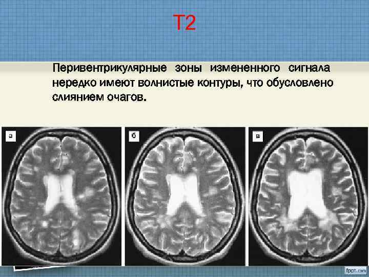 Ситуационный невроз карта вызова