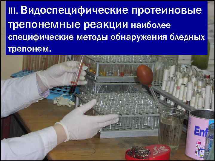 III. Видоспецифические  протеиновые трепонемные реакции наиболее специфические методы обнаружения бледных трепонем. 
