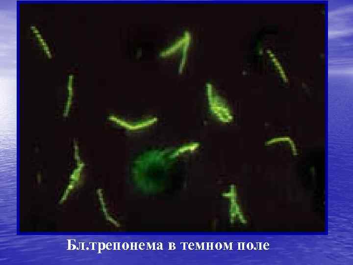 Бл. трепонема в темном поле 