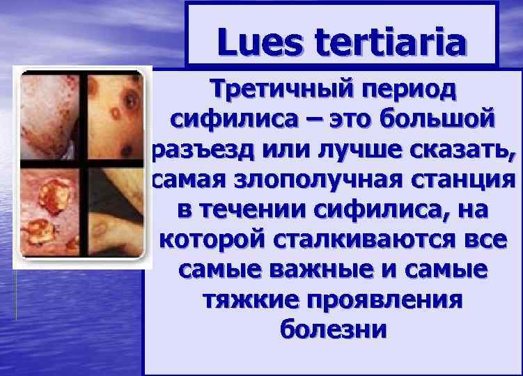   Lues tertiaria  Третичный период  сифилиса – это большой разъезд или