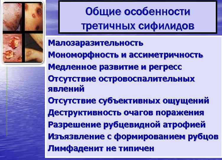   Общие особенности  третичных сифилидов Малозаразительность Мономорфность и ассиметричность Медленное развитие и