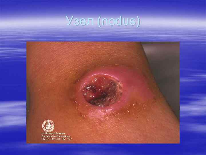 Узел (nodus) Узел (nodus)