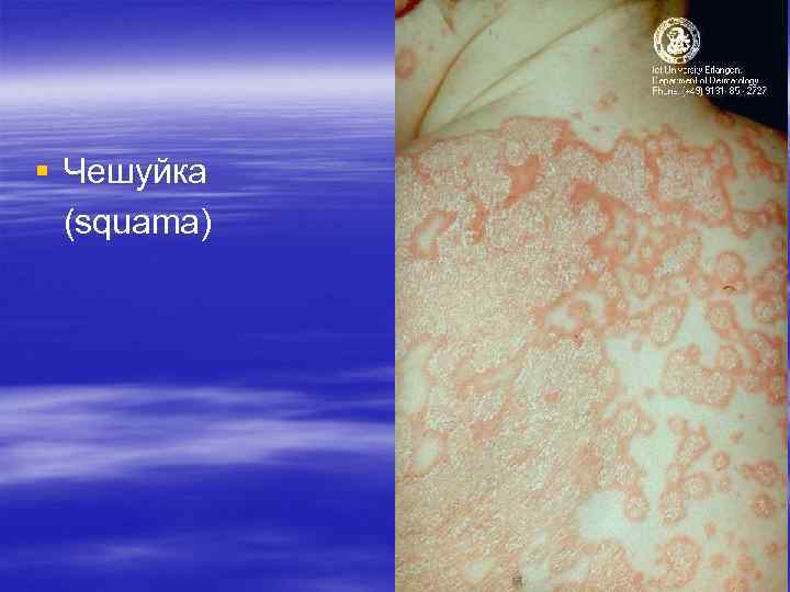 § Чешуйка (squama) § Чешуйка (squama)