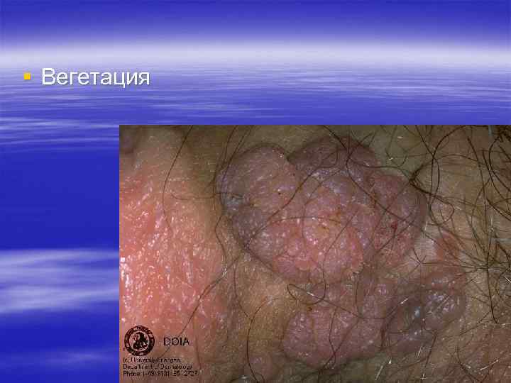 § Вегетация § Вегетация