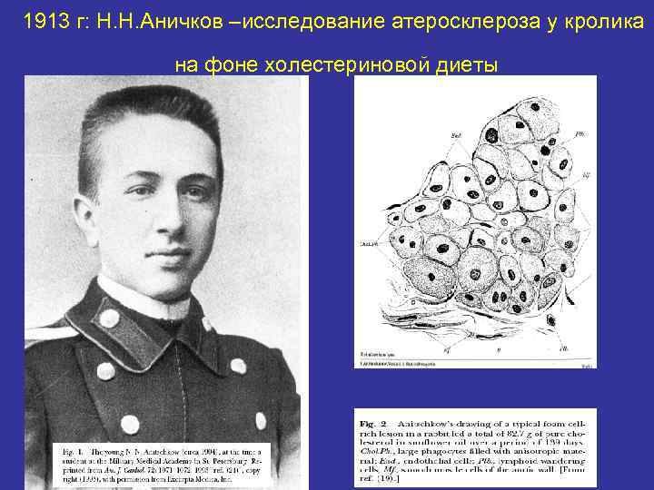 1913 г: Н. Н. Аничков –исследование атеросклероза у кролика    на фоне