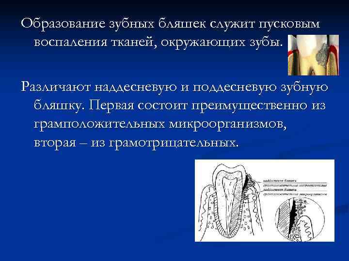 Схема формирования зубной бляшки