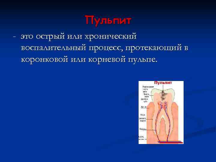     Пульпит - это острый или хронический  воспалительный процесс, протекающий