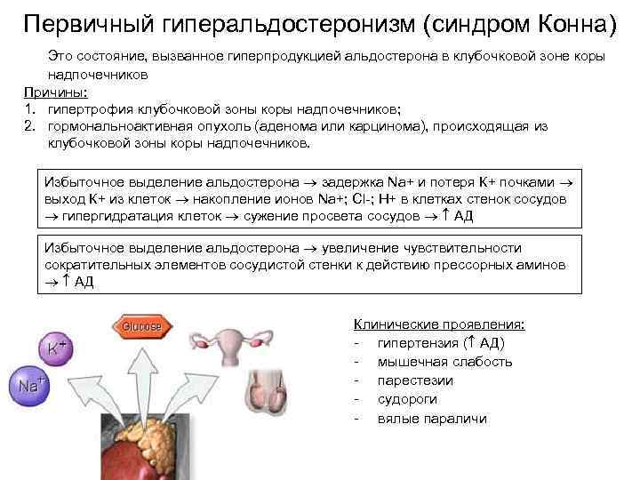 Синдром конна картинки