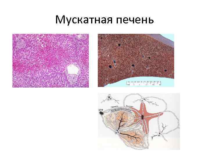 Мускатная печень 