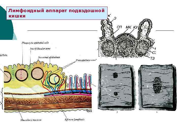 Лимфоидный аппарат подвздошной кишки 