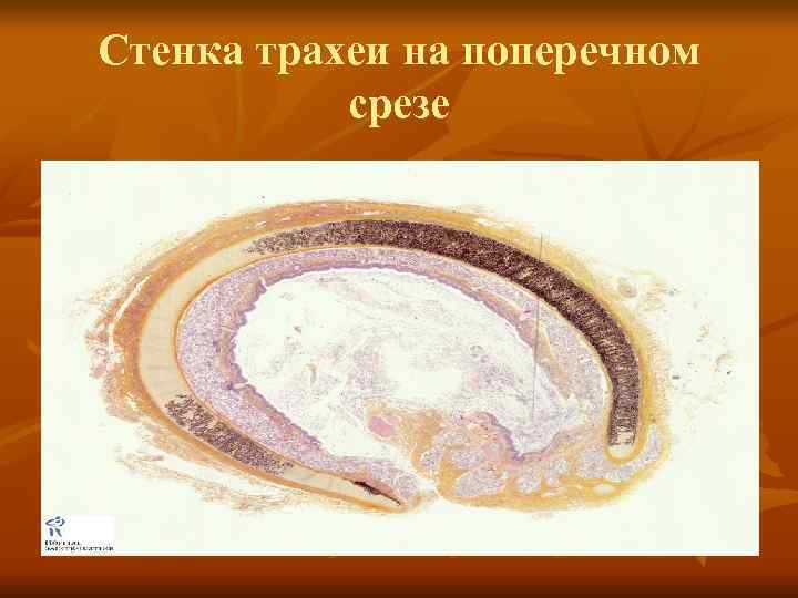 Стенка трахеи на поперечном  срезе 