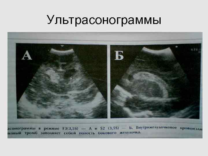 Ультрасонограммы Ультрасонограммы