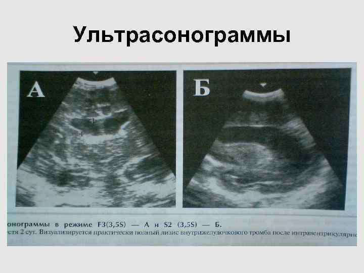 Ультрасонограммы Ультрасонограммы
