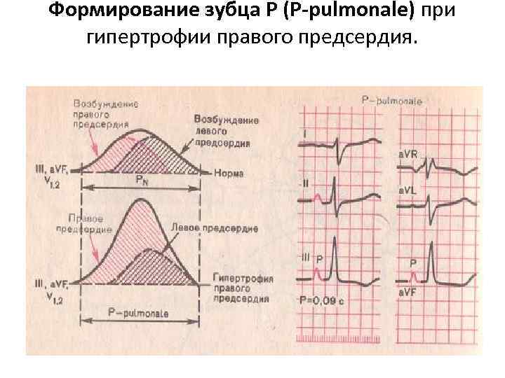 Пульмонология — Википедия