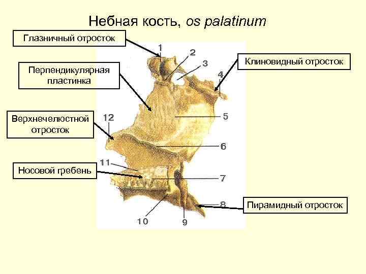 Небная кость