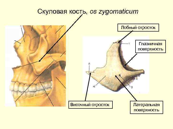 Анатомия скуловой кости. Скуловая кость (os zygomaticum). Скуловая кость лобный отросток. Анатомия скуловой кости и дуги. Скуловая кость поверхности и отростки.